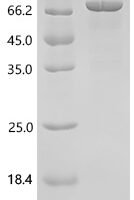 Human Ribosyldihydronicotinamide dehydrogenase [quinone] (NQO2), Biotinylated Recombinant Protein - BioCrest Sci