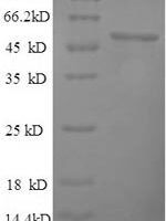 Saccharomyces cerevisiae Pyruvate carboxylase 1 (PYC1), partial Recombinant Protein, N-His, aa 18–470, Yeast - BioCrest Sci