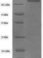 Human Prothrombin (F2) Recombinant Protein, N-His-SUMO - BioCrest Sci