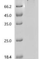 Human Catenin beta-1 (CTNNB1) Recombinant Protein, C-His - BioCrest Sci