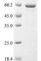 Human Transcription factor E2F1 (E2F1) Recombinant Protein - BioCrest Sci
