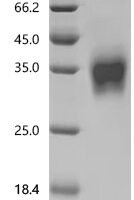 Mouse Interferon beta (Ifnb1) Recombinant Protein - BioCrest Sci