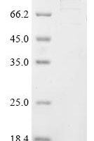 Human Origin recognition complex subunit 1 (ORC1) Recombinant Protein, N-GST - BioCrest Sci
