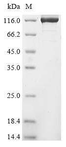 Human Origin recognition complex subunit 1 (ORC1) Recombinant Protein, N-GST, Homo sapiens (Human), E.coli, N-terminal GST-tagged, 123.6 kDa, purity >≥ 85% as determined by SDS-PAGE.