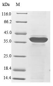 Human Small ribosomal subunit protein uS2 (RPSA) Recombinant Protein, N-10His/C-Myc, Homo sapiens (Human), E.coli, N-terminal 10xHis-tagged and C-terminal Myc-tagged, 37.7 kDa, purity >≥ 85% as determined by SDS-PAGE.