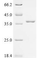 Mycobacterium bovis Diacylglycerol acyltransferase/mycolyltransferase Ag85B (fbpB) Recombinant Protein, C-His - BioCrest Sci