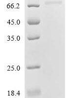 Human Glutamate receptor 2 (GRIA2), partial Recombinant Protein, C-His - BioCrest Sci