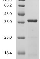 Human Delta(14)-sterol reductase LBR (LBR), partial Recombinant Protein, C-His - BioCrest Sci