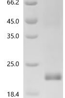 Human Inhibin beta A chain (INHBA) Recombinant Protein, C-His - BioCrest Sci