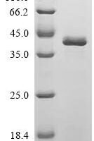 Human Hereditary hemochromatosis protein (HFE), partial Recombinant Protein, C-His - BioCrest Sci