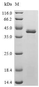 Human Hereditary hemochromatosis protein (HFE), partial Recombinant Protein, C-His, Homo sapiens (Human), E.coli, C-terminal 6xHis-tagged, 40.1 kDa, purity >≥ 90% as determined by SDS-PAGE.