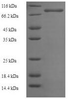 Human Phosphoinositide 3-kinase regulatory subunit 5 (PIK3R5) Recombinant Protein - BioCrest Sci