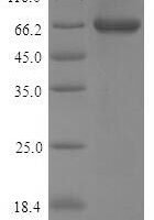 Mouse Pancreatic triacylglycerol lipase (Pnlip) Recombinant Protein - BioCrest Sci