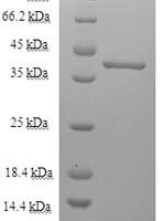 Toxocara canis 26 kDa secreted antigen (TES-26) Recombinant Protein, N-His-SUMO - BioCrest Sci