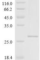 Human Erythroferrone (ERFE), partial Recombinant Protein, N-His - BioCrest Sci