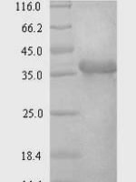 Human Syndecan-4 (SDC4), partial Recombinant Protein - BioCrest Sci