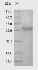 Human Syndecan-4 (SDC4), partial Recombinant Protein, Homo sapiens (Human), E.coli, N-terminal 6xHis-SUMO-tagged, 29.9 kDa, purity >≥ 90% as determined by SDS-PAGE.