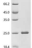 Human Galectin-9 (LGALS9), partial Recombinant Protein, N-His - BioCrest Sci