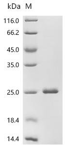 Human Galectin-9 (LGALS9), partial Recombinant Protein, N-His, Homo sapiens (Human), E.coli, N-terminal 6xHis-tagged, 22.9 kDa, purity >≥ 90% as determined by SDS-PAGE.