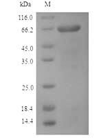 Influenza B virus Nucleoprotein (NP) Recombinant Protein, N-His - BioCrest Sci