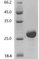 Rat Apolipoprotein A-I (Apoa1), partial Recombinant Protein, N-His - BioCrest Sci