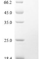 Human Histone-lysine N-methyltransferase EZH2 (EZH2) Recombinant Protein - BioCrest Sci
