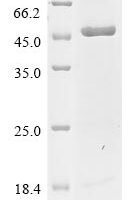 Human Cyclic GMP-AMP synthase (CGAS), partial Recombinant Protein - BioCrest Sci