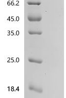Rat Natriuretic peptides B (Nppb), partial Recombinant Protein, C-His, aa 77–121 - BioCrest Sci