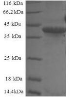 Human Small nuclear ribonucleoprotein Sm D2 (SNRPD2) Recombinant Protein - BioCrest Sci