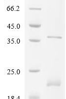 Human papillomavirus 11 Protein E7 (E7) Recombinant Protein, C-His - BioCrest Sci