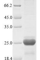 Hordeum vulgare Dehydrin DHN1 (DHN1) Recombinant Protein, N-10His/C-Myc, aa 1–139, Baculovirus - BioCrest Sci