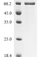 Human IL-12 receptor beta component (IL12RB1), partial Recombinant Protein, C-10His, aa 24–545 - BioCrest Sci