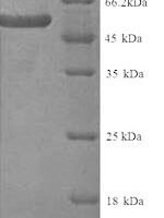 Human KeRatin, type II cytoskeletal 4 (KRT4) Recombinant Protein - BioCrest Sci
