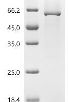 Human Protein-glutamine gamma-glutamyltransferase K (TGM1), partial Recombinant Protein, C-His, aa 41–510 - BioCrest Sci