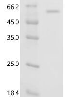 Human DDB1-and CUL4-associated factor 16  (DCAF16) Recombinant Protein - BioCrest Sci