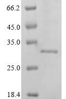 Mouse Troponin I, cardiac muscle (Tnni3) Recombinant Protein, Tag-Free - BioCrest Sci
