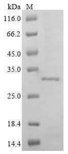 Mouse Troponin I, cardiac muscle (Tnni3) Recombinant Protein, Tag-Free, Mus musculus (Mouse), E.coli, Tag-Free, 24.1 kDa, purity >≥ 85% as determined by SDS-PAGE.