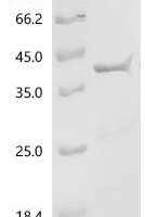 Bordetella pertussis Filamentous hemagglutinin (fhaB), partial Recombinant Protein, C-His, aa 2119–2361 - BioCrest Sci