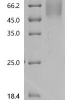 Human V-type proton ATPase subunit C 1 (ATP6V1C1) Recombinant Protein, N-His, aa 2–382, Yeast - BioCrest Sci
