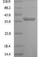 Arabidopsis thaliana Cyclin-dependent kinase B1-2 (CDKB1-2) Recombinant Protein - BioCrest Sci