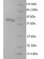 Drosophila melanogaster Partner of bursicon (pburs) Recombinant Protein - BioCrest Sci