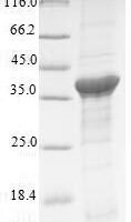 Human Renin receptor (ATP6AP2) Recombinant Protein - BioCrest Sci