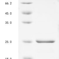 Human Beta-synuclein (SNCB) Recombinant Protein - BioCrest Sci