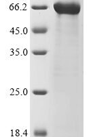 Human SWI/SNF-related matrix-associated actin-dependent regulator of chromatin subfamily A member 4 (SMARCA4), partial Recombinant Protein - BioCrest Sci