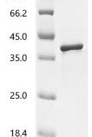 Human Eukaryotic translation initiation factor 4E type 2 (EIF4E2) Recombinant Protein - BioCrest Sci