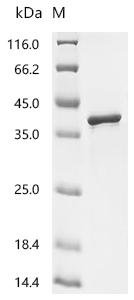 Human Eukaryotic translation initiation factor 4E type 2 (EIF4E2) Recombinant Protein, Homo sapiens (Human), E.coli, C-terminal 6xHis-tagged, 35.3 kDa, purity >≥ 90% as determined by SDS-PAGE.