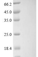 Methanothermus fervidus DNA-binding protein HMf-2 (hmfB) Recombinant Protein - BioCrest Sci