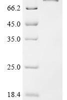 Mouse L-amino-acid oxidase (Il4i1) Recombinant Protein - BioCrest Sci