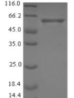 Staphylococcus aureus Enolase (eno) Recombinant Protein, N-His-SUMO - BioCrest Sci
