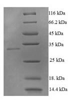 Human Tumor necrosis factor ligand superfamily member 10 (TNFSF10), partial Recombinant Protein, N-His - BioCrest Sci